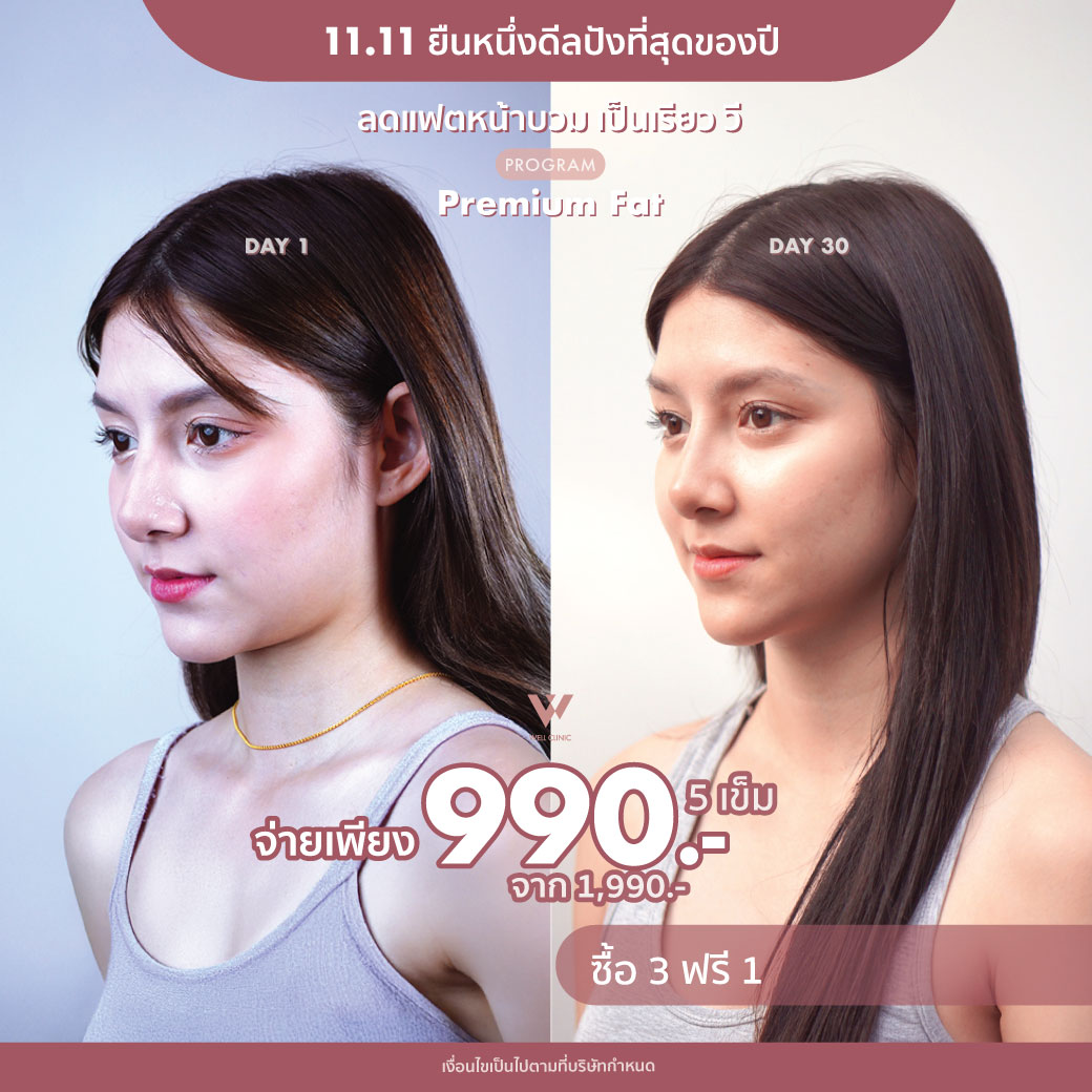 AW_D14_Nov25_A2_1040.1040_0