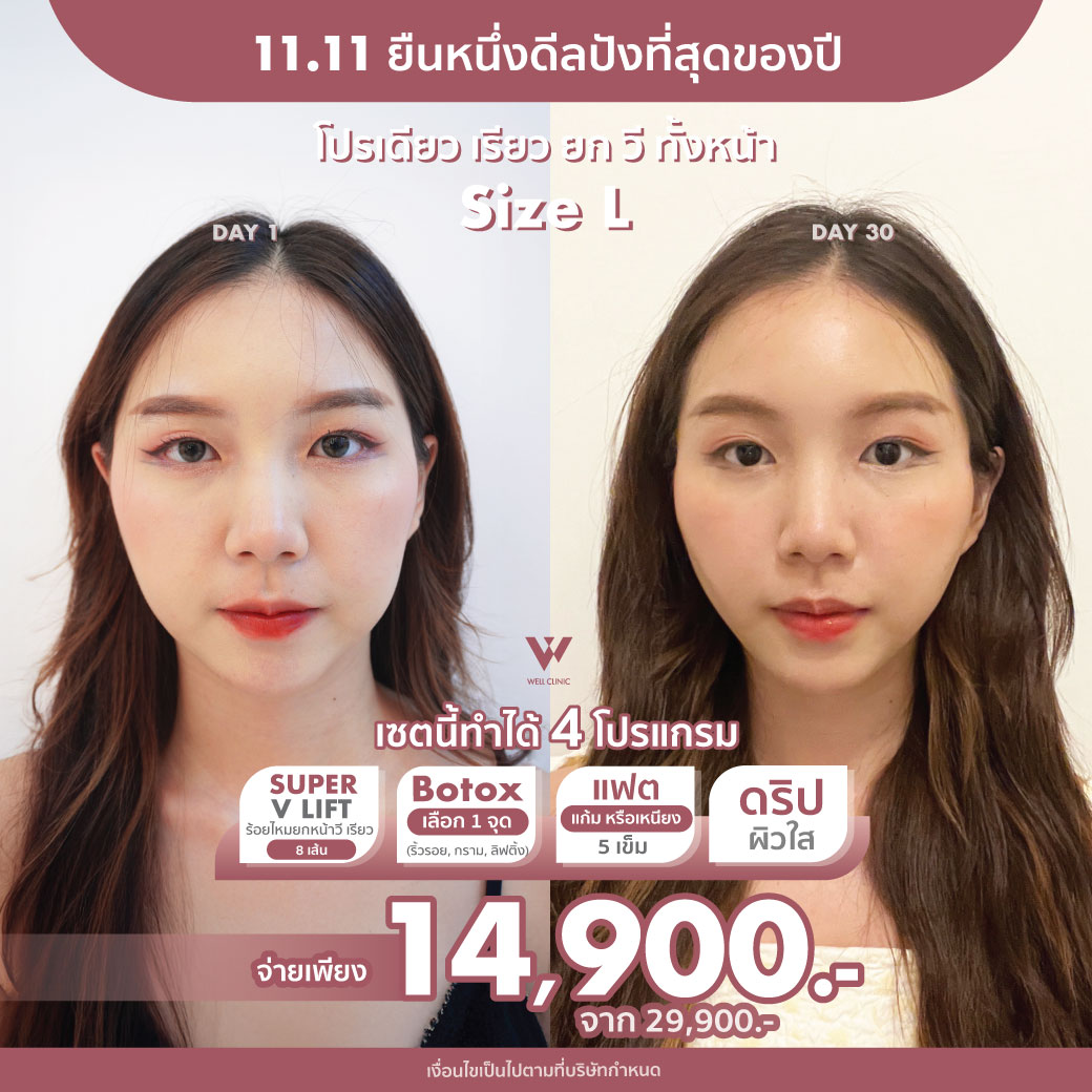 AW_D2_A3_Nov25_1040.1040_0