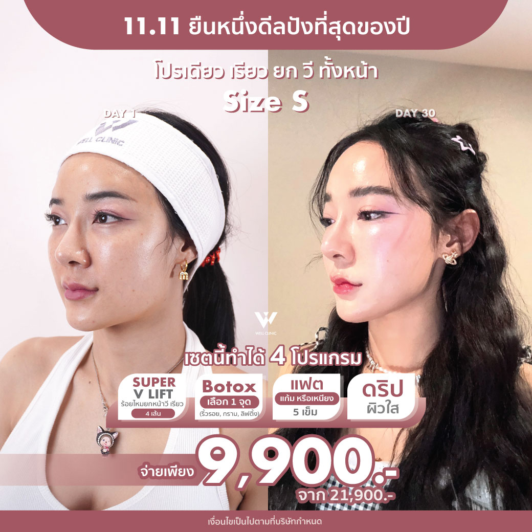 AW_D2_Nov25_A1_1040.1040_0