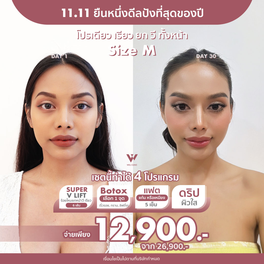 AW_D2_Nov25_A2_1040.1040_0