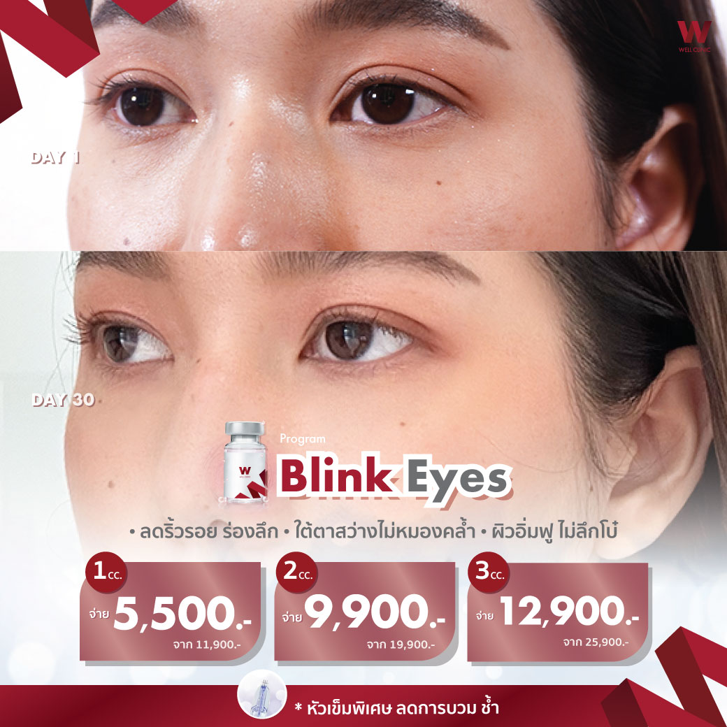 Blink-Eyes_1040.1040_New_0