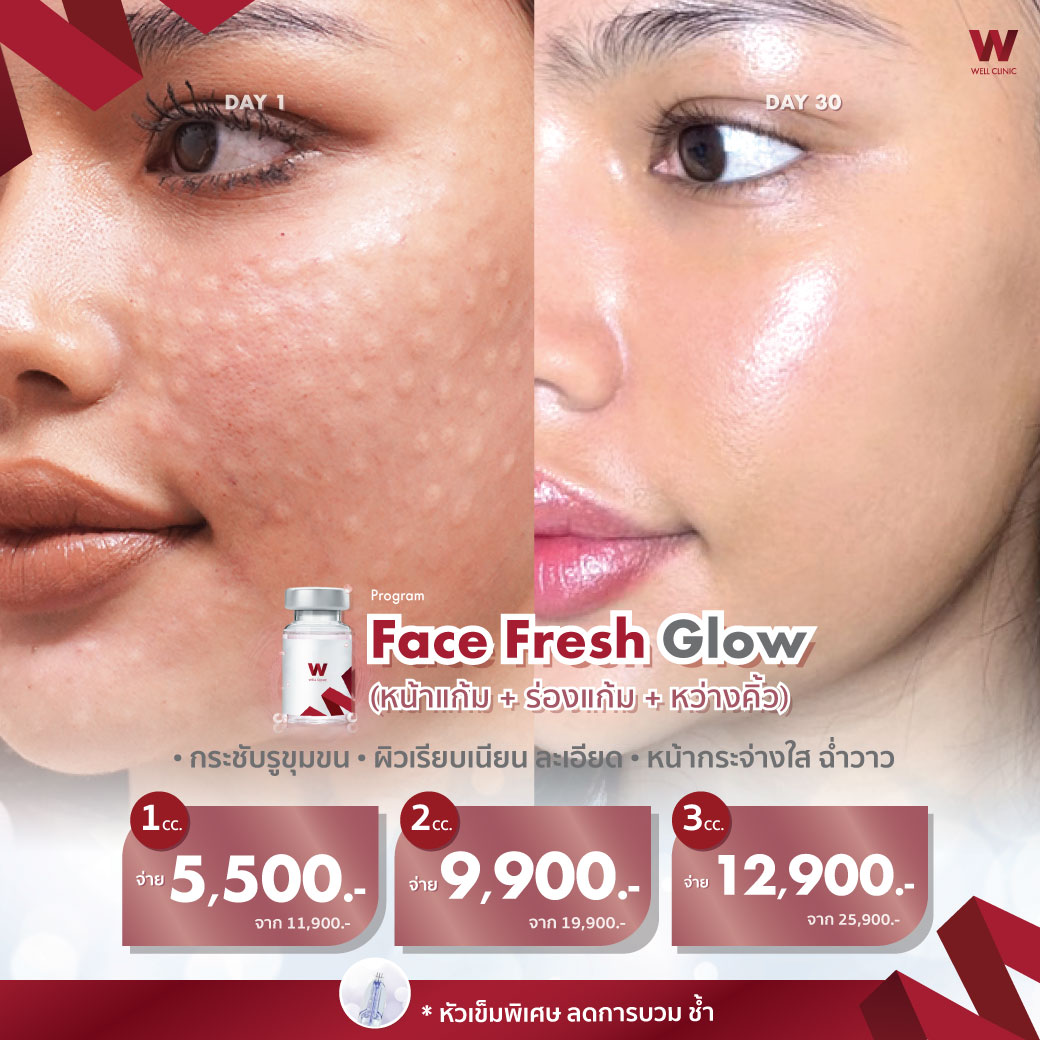 Face-Fresh-Glow_1040.1040_New_0
