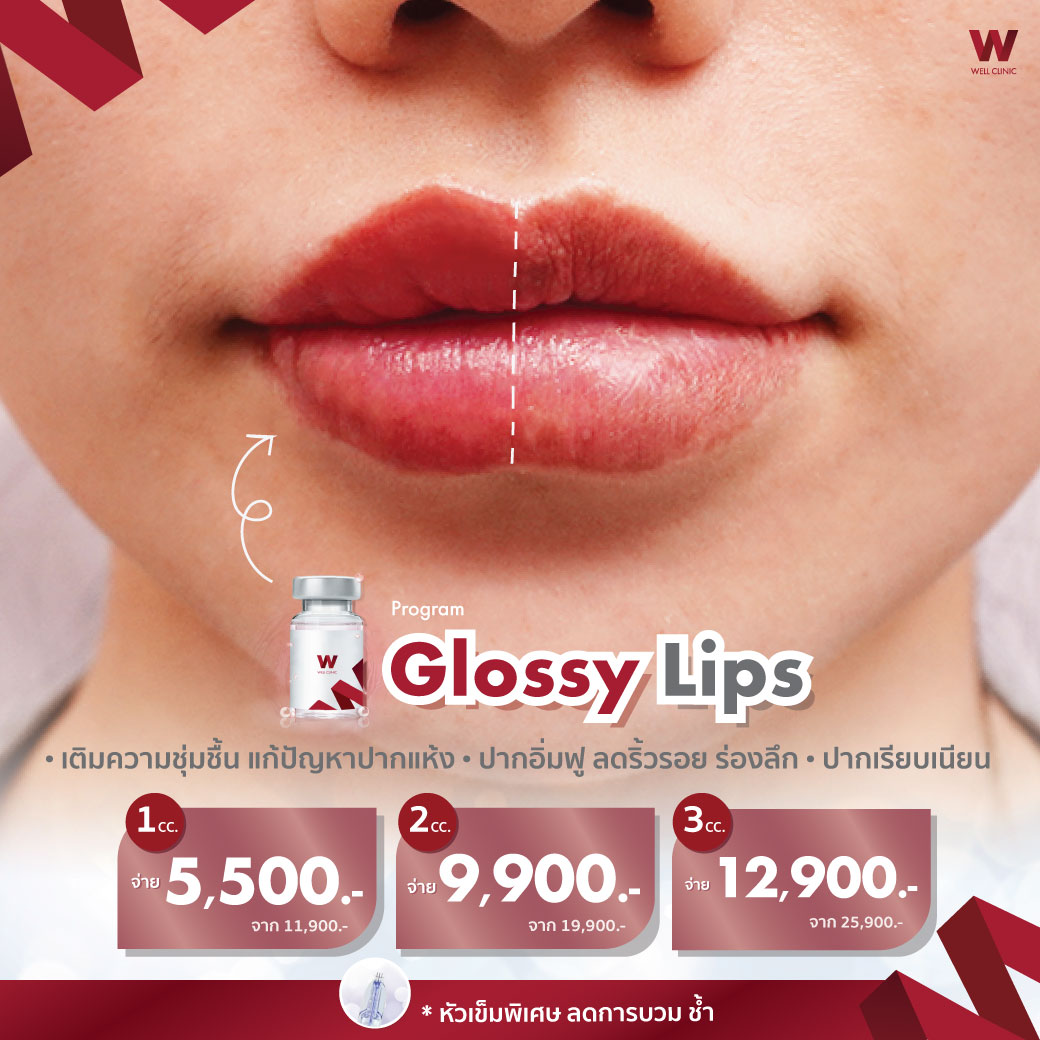 Glossy-Lips_1040.1040_New_0