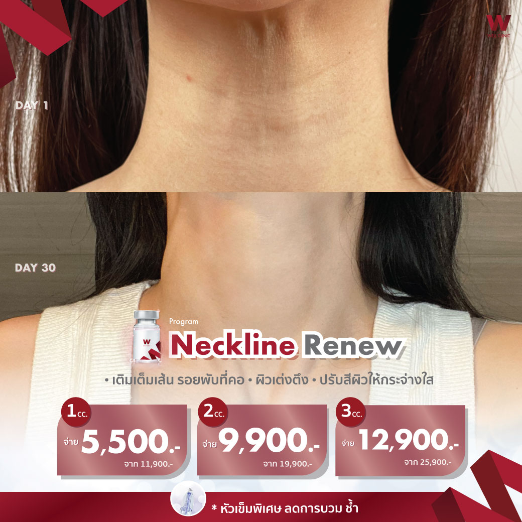 Neckline-Renew_1040.1040_New_0